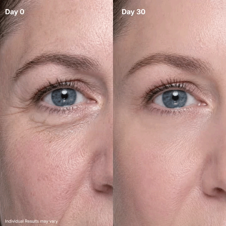 🔥Final 2 Hour 50% OFF🔥 AQA P7 Eye Renewal Cream